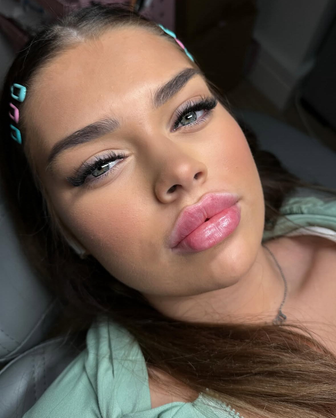 Dermal Filler Packages